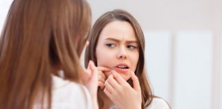 sivilce nasıl geçer