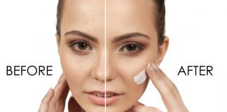 roaccutane yan etkileri