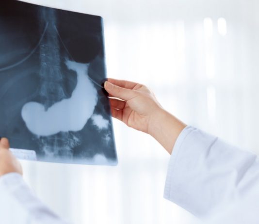 pankreas hastalıkları