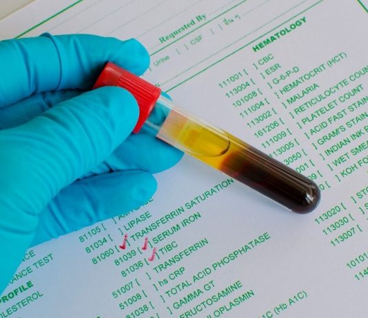 demir eksikliği belirtileri