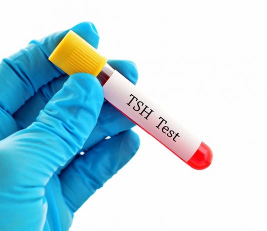 tsh nedir