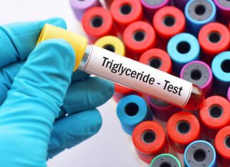 trigliserid nedir