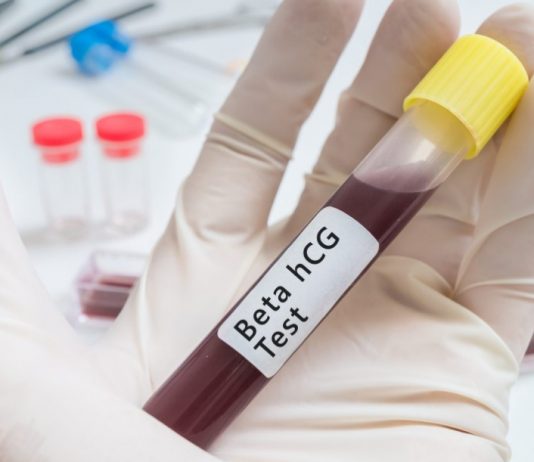 Beta HCG Değeri Nedir, Beta Hcg Değerine Göre Hamilelik Haftanız beta hcg testi