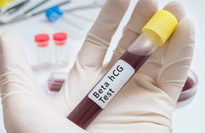 beta hcg testi