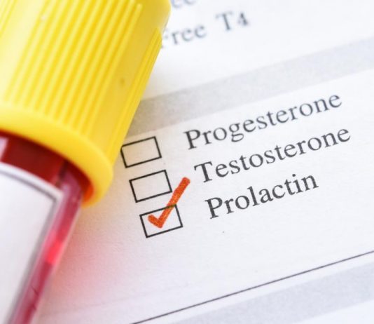 Prolaktin Hormonu Nedir ? Prolaktin Yüksekliği Ne Anlama Gelir ? prolaktin nedir