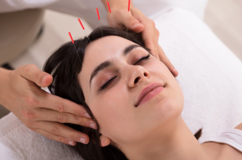 akupunktur ile zayıflama